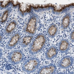 VPS53 Antibody, Novus Biologicals 25 &mu;L; Unlabeled:Antibodies, Polyclonal